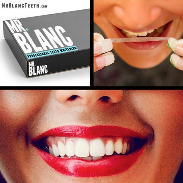 mr blanc teeth strips reviews